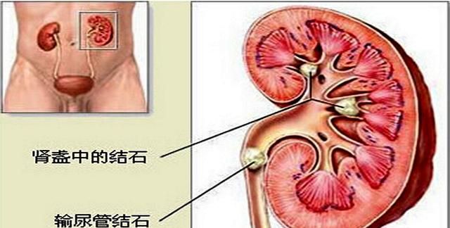 吃菠菜到底能不能补铁补血,补铁补血的最好方法菠菜猪肝图13