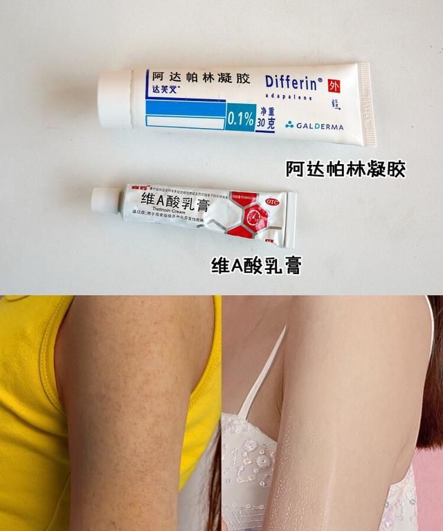 身上的皮肤粗糙怎么办图4