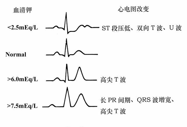 高钾血症如何降钾图6