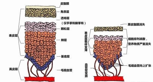 抗红血丝，红血丝怎么去除最有效图1